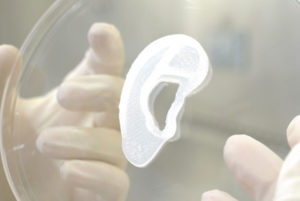 3DBio Therapeutics and the Microtia-Congenital Ear Deformity Institute Conduct Human Ear Reconstruction Using 3D-Bioprinted Living Tissue Implant in a First-in-Human Clinical Trial