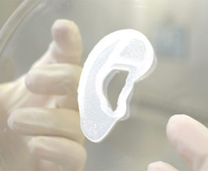 3DBio Therapeutics and the Microtia-Congenital Ear Deformity Institute Conduct Human Ear Reconstruction Using 3D-Bioprinted Living Tissue Implant in a First-in-Human Clinical Trial