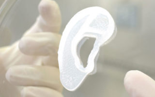 3DBio Therapeutics and the Microtia-Congenital Ear Deformity Institute Conduct Human Ear Reconstruction Using 3D-Bioprinted Living Tissue Implant in a First-in-Human Clinical Trial