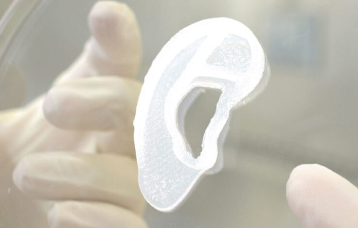 3DBio Therapeutics and the Microtia-Congenital Ear Deformity Institute Conduct Human Ear Reconstruction Using 3D-Bioprinted Living Tissue Implant in a First-in-Human Clinical Trial